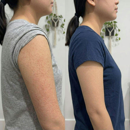 Crème Complexe Triple Acide contre la kératose